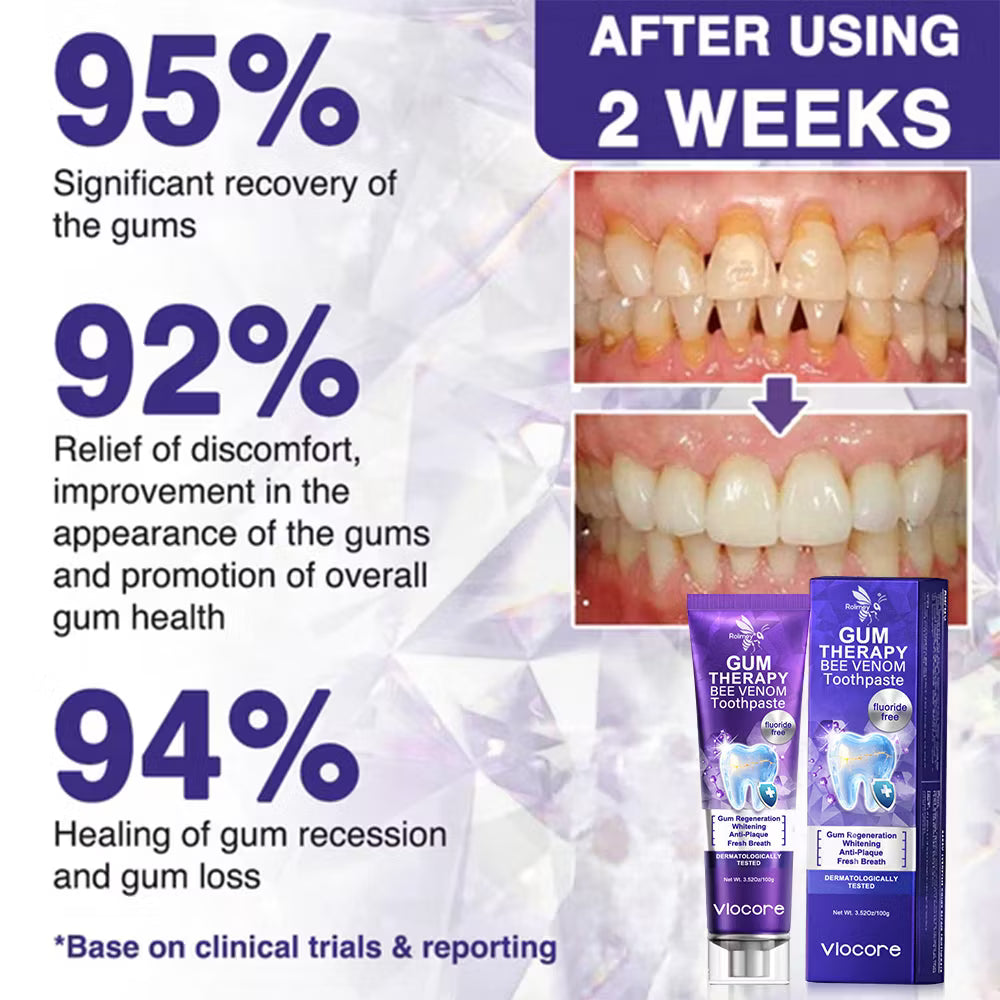 Rolimey® VioCore Bee Venom Dental Treatment Toothpaste (IMPORTED)