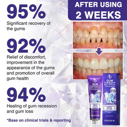Rolimey® VioCore Bee Venom Dental Treatment Toothpaste (IMPORTED)