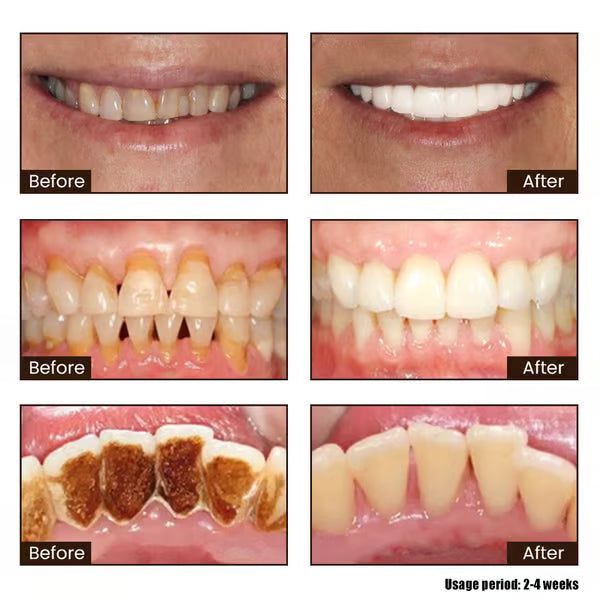 New 7-Pro Intensive Toothpaste | Upgraded Purple Formula with 7 Probiotics | Deep Enamel Repair & Long-Lasting Freshness
