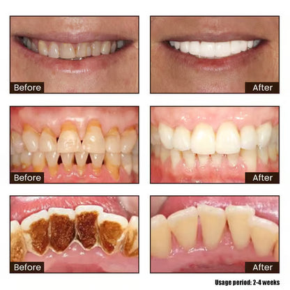 New 7-Pro Intensive Toothpaste | Upgraded Purple Formula with 7 Probiotics | Deep Enamel Repair & Long-Lasting Freshness