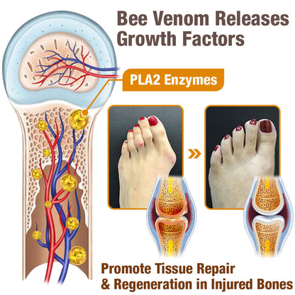 HalluxCare Bee Venom Treatment Cream