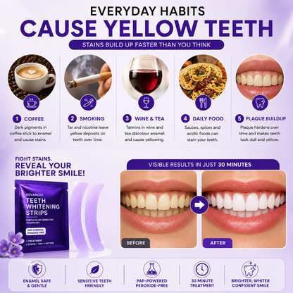 Purple Whitening Strip - Pack of 14 Strips