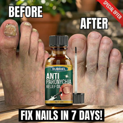 🔥BUY 1 GET 1 FREE🔥 Anti Paronychia Relief Oil