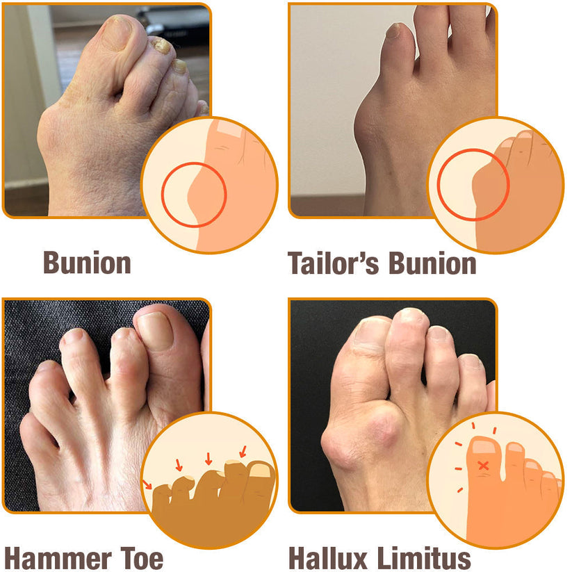 HalluxCare Bee Venom Treatment Cream