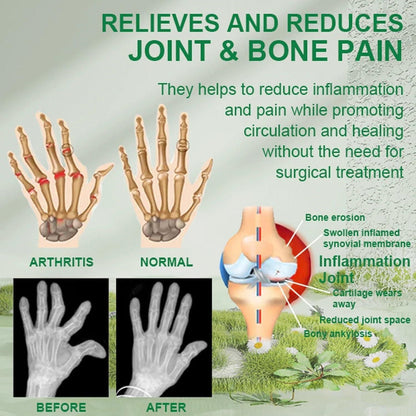 Bee Venom Joint And Bone Therapy Cream - BUY 1 GET 1 FREE