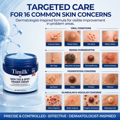 Timilk® 7-Day Skin Tag & Spot Eraser Cream - PACK OF 2 (IMPORTED)