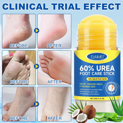 60% Urea Exfoliating Foot Cream Stick