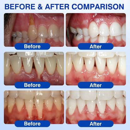 TIWORLD ® Gum health Periodontal Repair Gel
