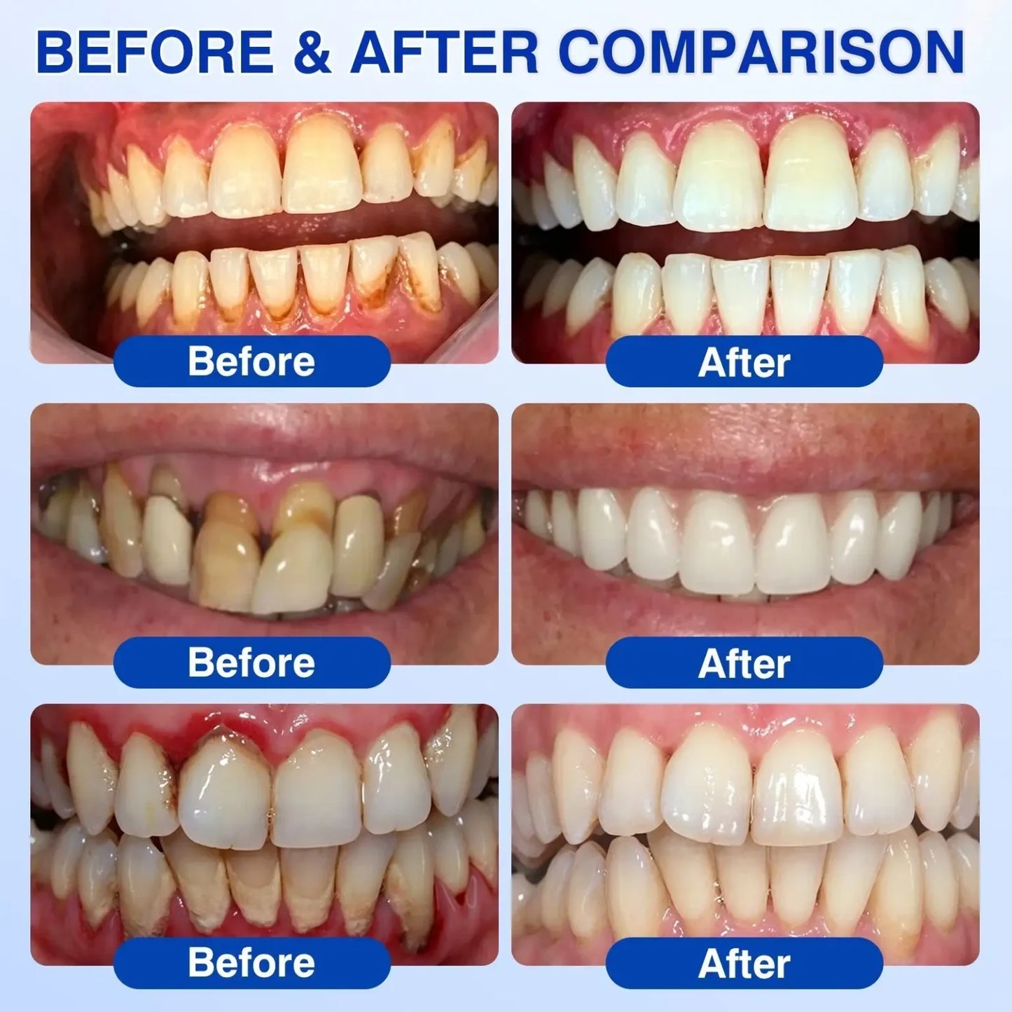TIWORLD ® Gum health Periodontal Repair Gel