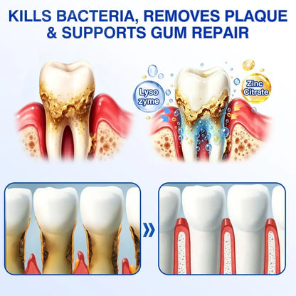 TIWORLD ® Gum health Periodontal Repair Gel