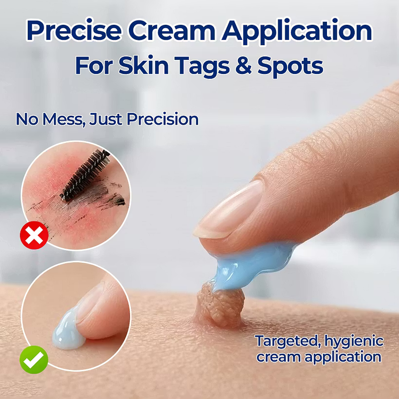 Timilk® 7-Day Skin Tag & Spot Eraser Cream - PACK OF 2 (IMPORTED)
