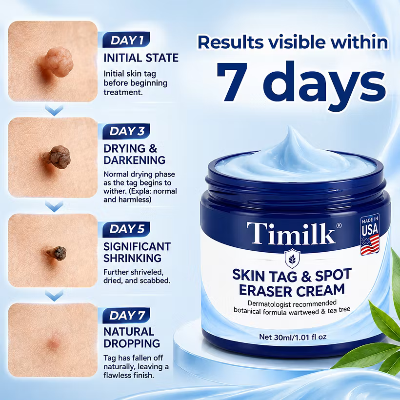 Timilk® 7-Day Skin Tag & Spot Eraser Cream - PACK OF 2 (IMPORTED)
