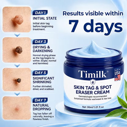 Timilk® 7-Day Skin Tag & Spot Eraser Cream - PACK OF 2 (IMPORTED)
