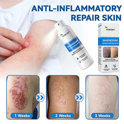 KUBOZN® Magnesium Herbal Spray – Fast Relief for Psoriasis & Eczema | No-Rub, Steroid-Free (IMPORTED)