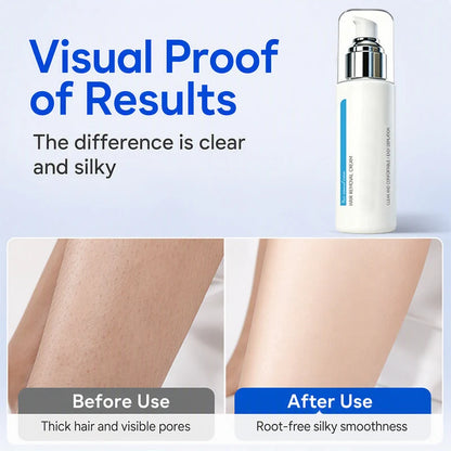 ✨Ice-Cooling Hair Removal Cream for Sensitive Skin